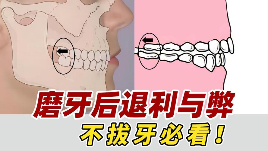 不拔牙矫正牙齿有哪些可行方法？效果如何？-图1