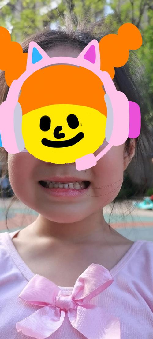 宝宝牙齿反颌矫正图片能看懂矫正方案吗？-图2