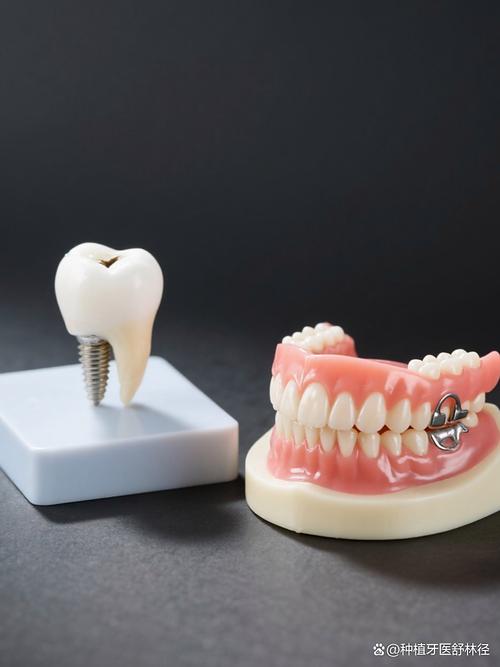 戴假牙能做牙齿矫正吗？-图3