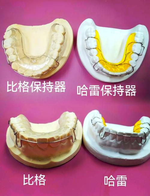 牙齿矫正里的铁丝到底是什么材质？-图2