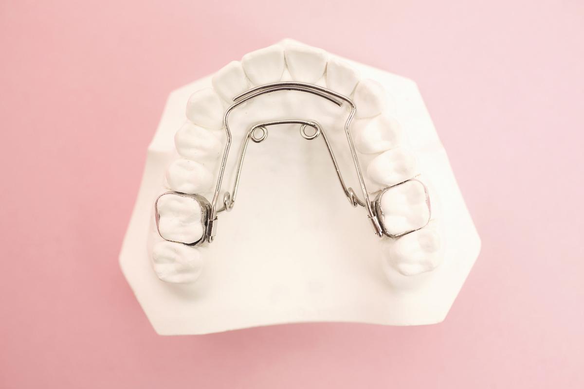 单晶托槽牙齿矫正图片-图1