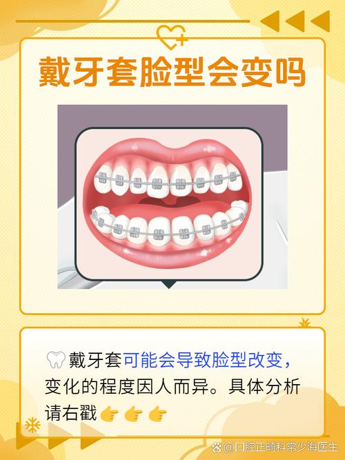 矫正牙齿多久脸型会发生变化？-图3