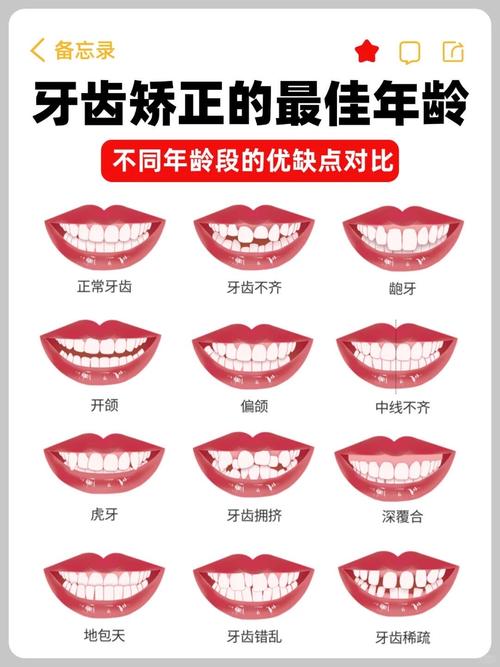 矫正牙齿多久脸型会发生变化？-图2
