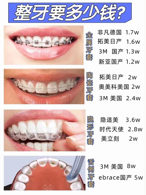 成人矫正牙齿需要多钱-图1