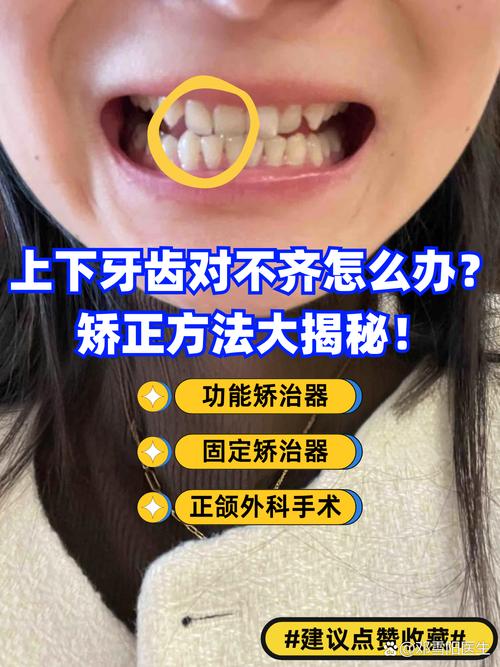 牙齿矫正是否会造成咬合不齐？-图2