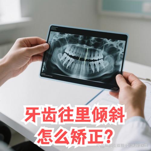 牙齿往里倒需要矫正吗？-图1