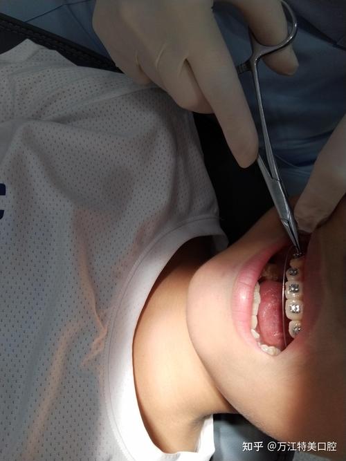 东莞牙齿矫正怎么选最正规？靠谱机构有哪些判断方法？-图2