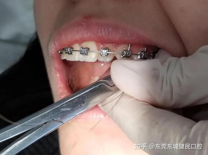 东莞牙齿矫正怎么选最正规？靠谱机构有哪些判断方法？-图3