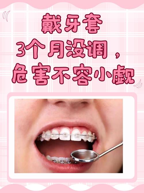 矫正牙齿后不痛正常吗-图3