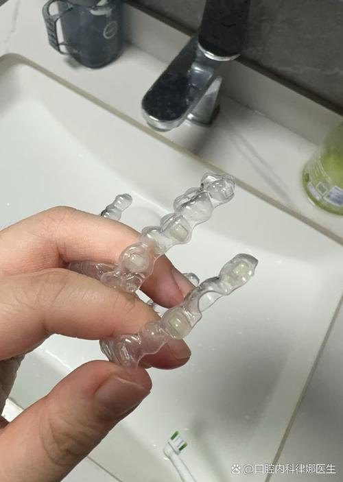 补过的牙齿还能矫正吗?-图3 补过的牙齿还能矫正吗?-图3