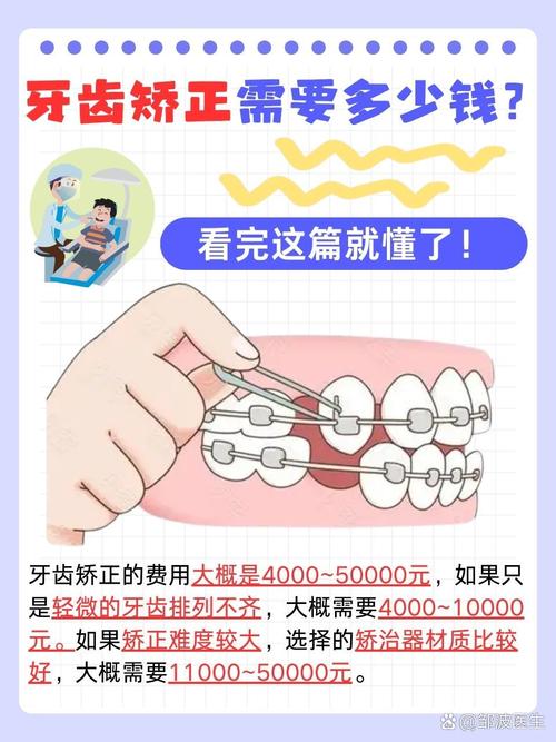 矫正牙齿可以换医院吗-图1 矫正牙齿可以换医院吗-图1