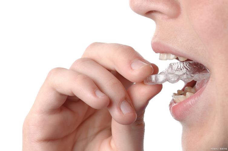 牙齿矫正疼不疼？专家详解疼痛程度与应对-图3