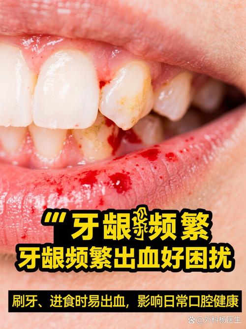 牙齿矫正期间牙龈出血-图1