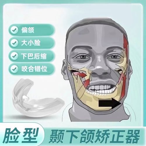 颞颌关节紊乱牙齿矫正-图2