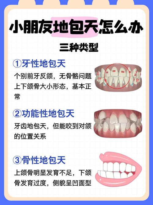地包天矫正示意图有哪些关键步骤？-图3
