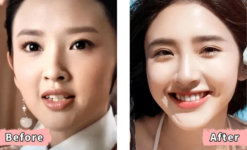 明星为何高龄矫正牙齿?晚矫正效果如何?-图2 明星为何高龄矫正牙齿?晚矫正效果如何?-图2