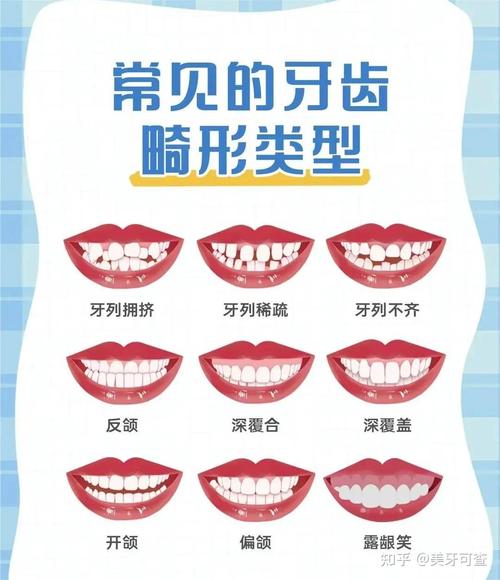 孕后矫正牙齿要等多久？最佳安全时间点是什么时候？-图2