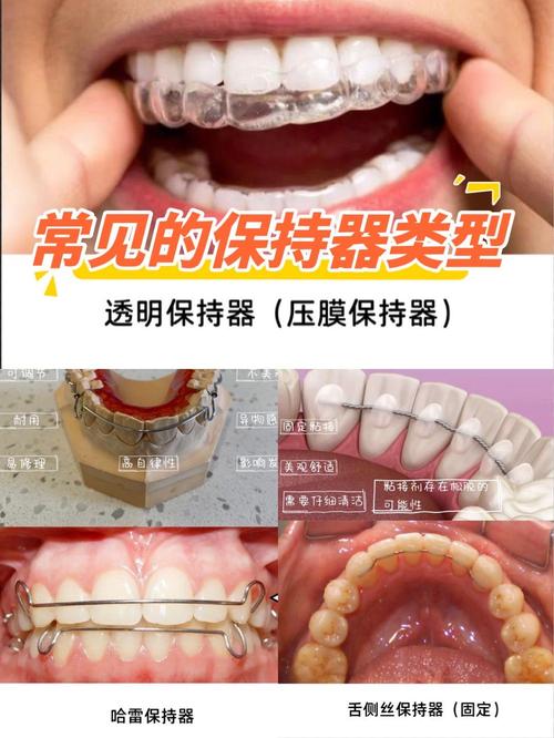 直接用保持器矫正牙齿，可行吗？效果与风险如何？-图2