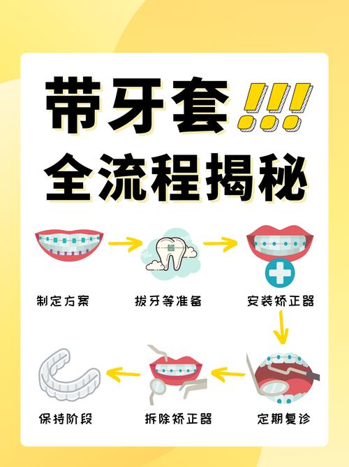 不用牙套矫正牙齿，有哪些可行替代方法？-图2