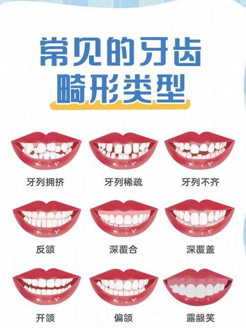 成都口腔医院牙齿矫正，选医院该看重资质还是医生技术？-图3