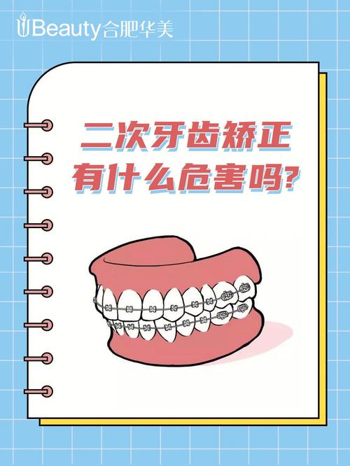 仿生冠矫正牙齿危害大吗？存在哪些潜在风险？-图1