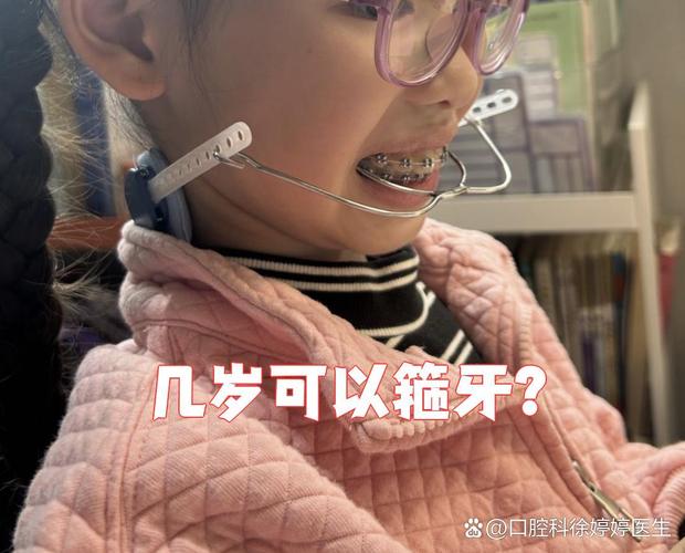 儿童牙齿矫正的黄金年龄是几岁？-图1