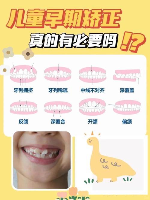 儿童牙齿矫正的黄金年龄是几岁？-图2