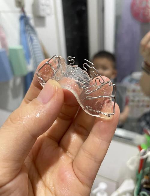 半隐形牙齿矫正对地包天的矫正效果怎么样？-图2