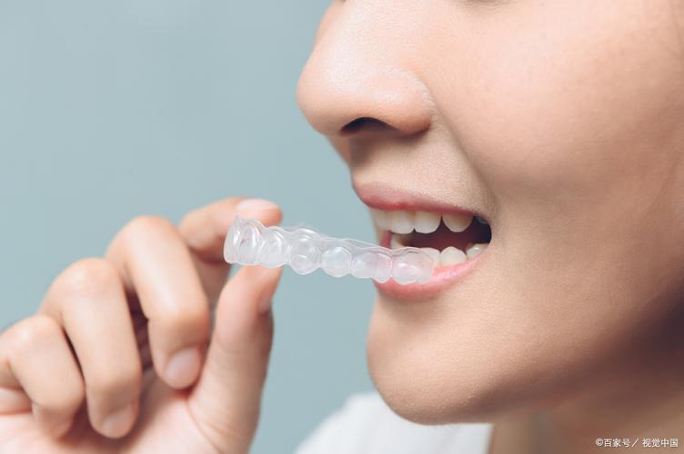 北京隐形牙套矫正怎么选？效果靠谱吗？-图2