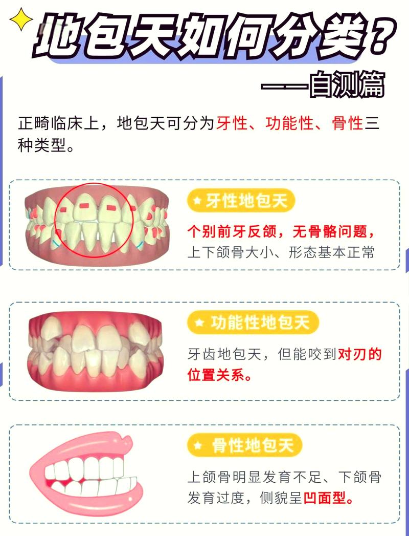地包天矫正几岁开始最合适?最佳年龄是多少岁?-图1 地包天矫正几岁开始最合适?最佳年龄是多少岁?-图1