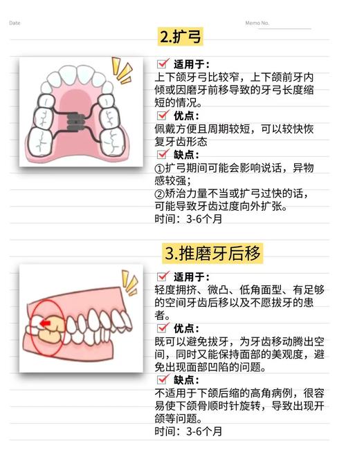 牙齿矫正什么情况需要拔牙？-图1