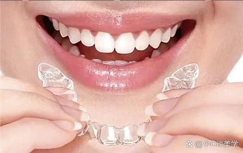 隐形矫正牙齿的最佳时间是什么时候?-图2 隐形矫正牙齿的最佳时间是什么时候?-图2