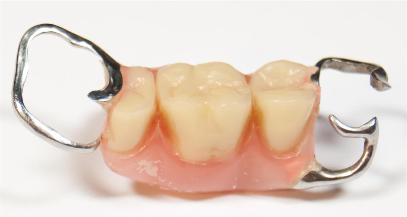 隐形矫正牙齿 可拆卸-图3