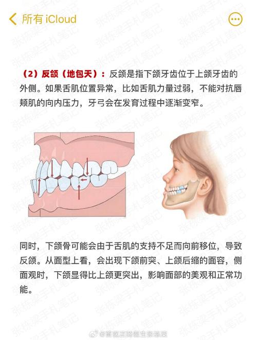 矫正期间咬合关系异常该如何调整?-图2 矫正期间咬合关系异常该如何调整?-图2