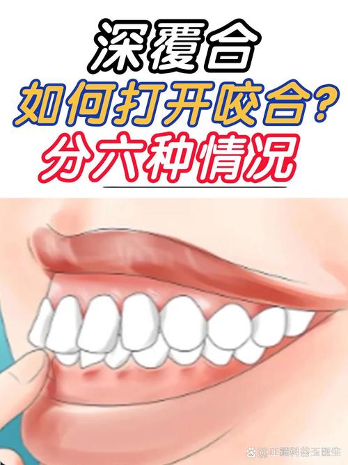 牙齿矫正如何调整咬合？实用方法有哪些？-图3