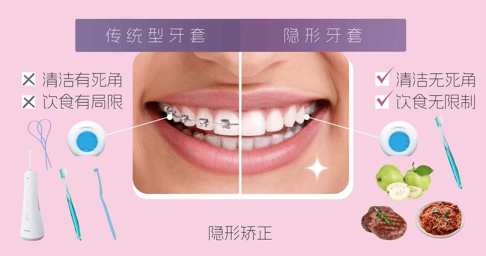 哪些牙齿情况适合隐形矫正?-图1 哪些牙齿情况适合隐形矫正?-图1