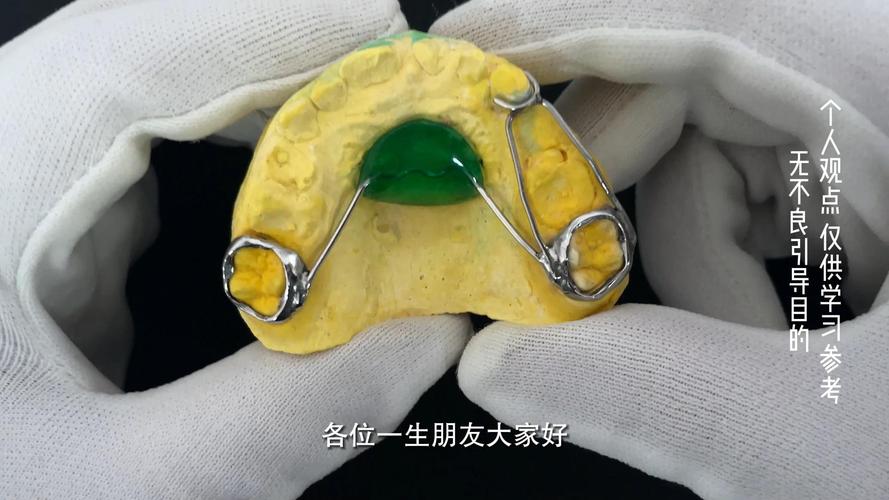 shiye牙齿矫正器矫正效果真的靠谱吗?使用体验如何?-图1 shiye牙齿矫正器矫正效果真的靠谱吗?使用体验如何?-图1