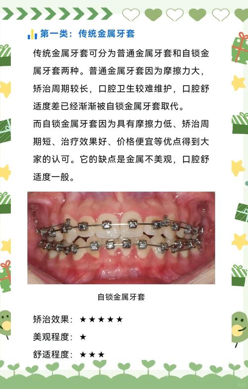 MBT矫正牙齿的副作用有哪些？是否会对牙齿健康造成影响？-图1