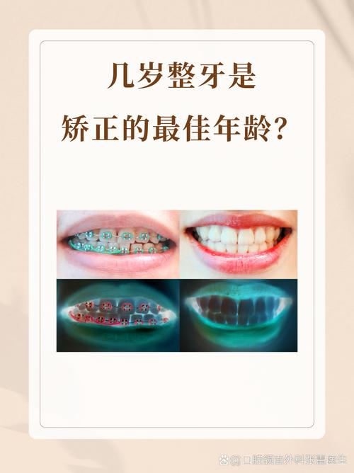 孩子矫正牙齿的最佳年龄是几岁？-图3