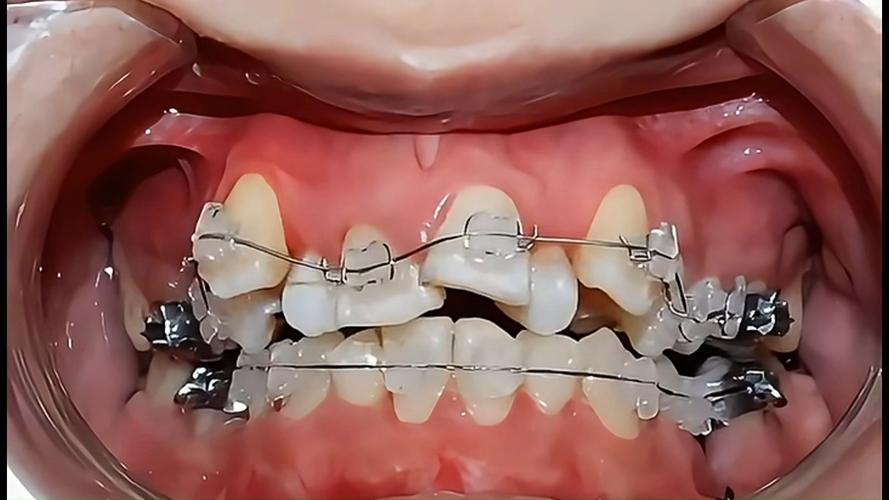 北京牙齿矫正哪家医院靠谱？-图2