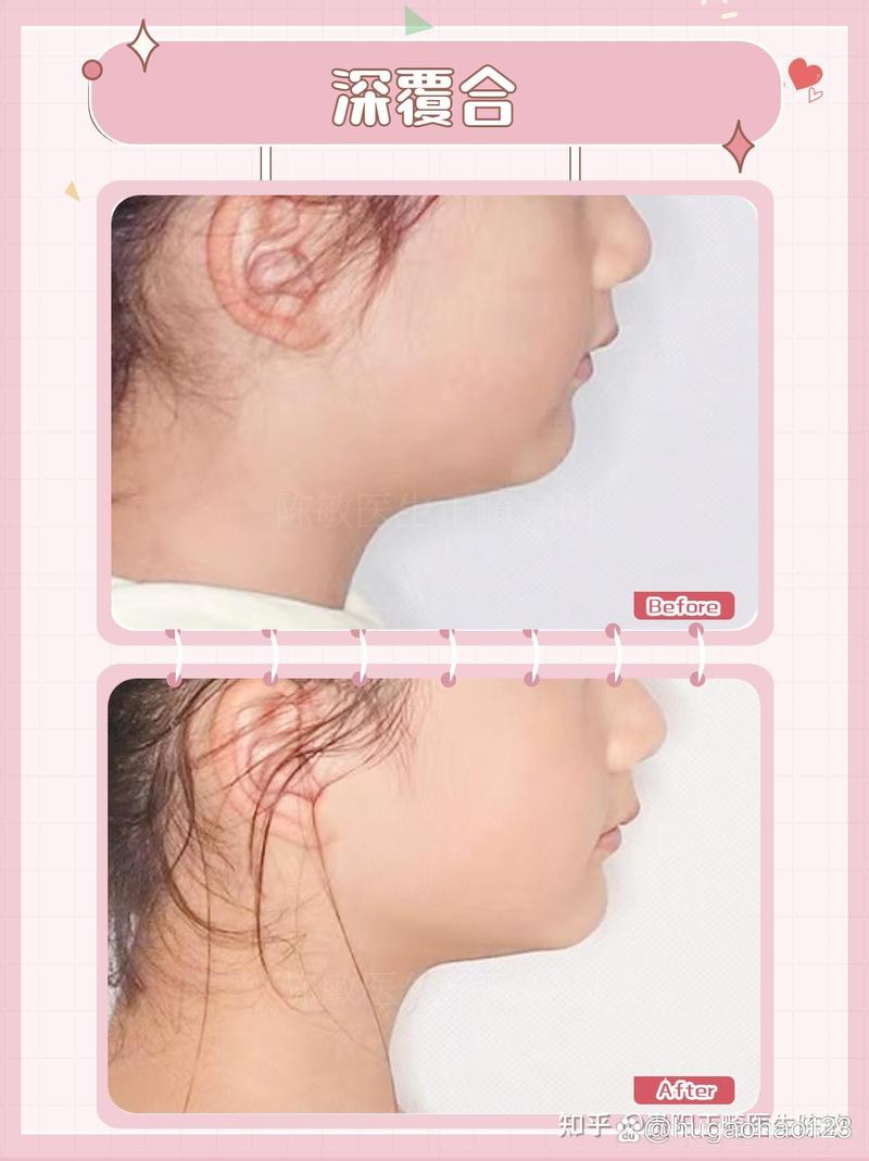 贵阳矫正牙齿去哪里？专业机构+价格与口碑推荐-图2