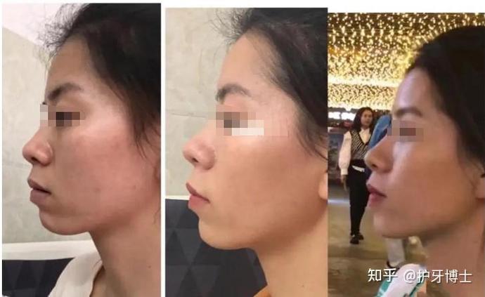 苏州矫正牙齿哪里最好?靠谱机构怎么挑?-图1 苏州矫正牙齿哪里最好?靠谱机构怎么挑?-图1