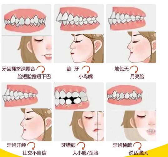 苏州矫正牙齿哪里最好?靠谱机构怎么挑?-图2 苏州矫正牙齿哪里最好?靠谱机构怎么挑?-图2