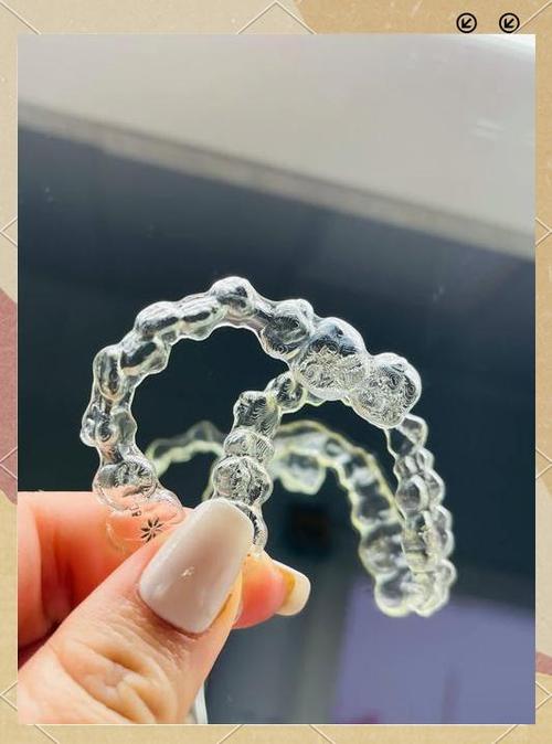 隐形牙齿矫正效果究竟如何？真实效果大揭秘？-图2