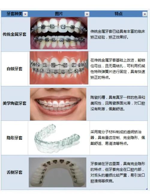 深圳隐形矫正牙齿分期怎么选？政策流程费用全攻略？-图3