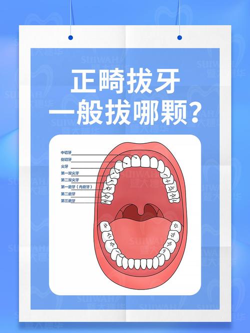 矫正牙齿拔哪几颗牙齿-图2