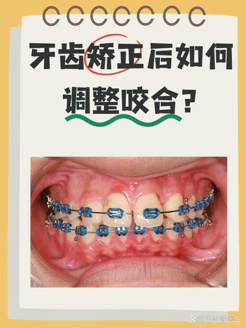 矫正牙齿牙齿咬合改变-图2