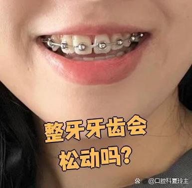 矫正牙齿感觉松动是正常现象吗？-图2