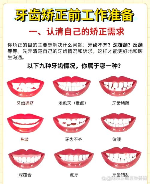 哪些牙齿状况或问题需要通过牙齿矫正来解决呢？-图1