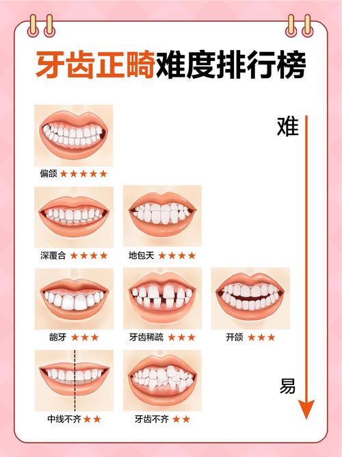 牙齿矫正牙齿移动速度越快越好吗？-图3